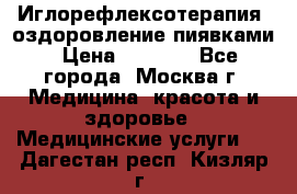 Иглорефлексотерапия, оздоровление пиявками › Цена ­ 3 000 - Все города, Москва г. Медицина, красота и здоровье » Медицинские услуги   . Дагестан респ.,Кизляр г.